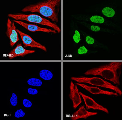 JunB Recombinant Rabbit mAb (S-670-242)