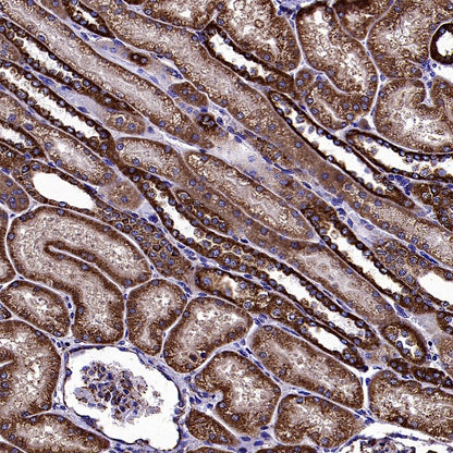 VDAC2 Rabbit Polyclonal Antibody