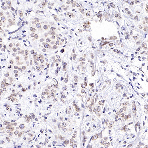 RanBP2 Recombinant Rabbit mAb (S-2593-310)