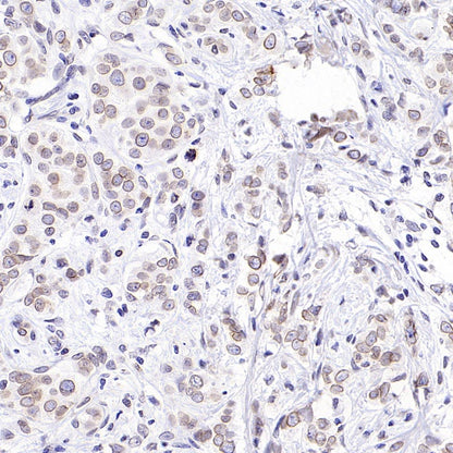 RanBP2 Recombinant Rabbit mAb (S-2593-310)
