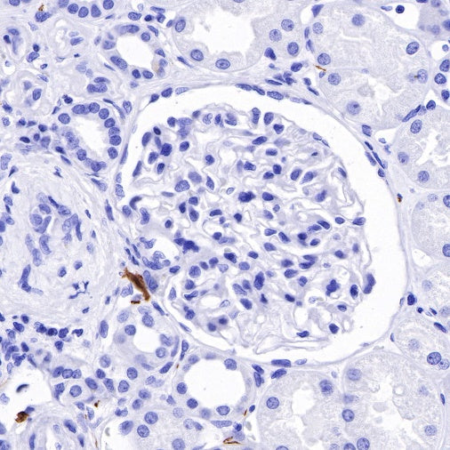 S-RMab® S100B Recombinant Rabbit mAb (SDT-518-45)