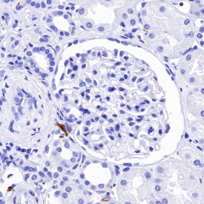 S-RMab® S100B Recombinant Rabbit mAb (SDT-518-45)