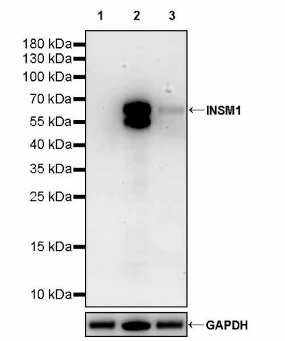 INSM1 Recombinant Rabbit mAb (SDT-3165-72)