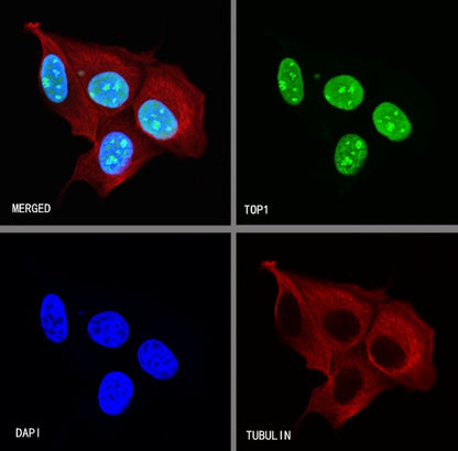 Topoisomerase I/TOP1 Recombinant Rabbit mAb (S-822-60)