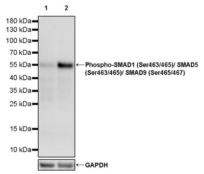 Phospho-SMAD1 (Ser463/465)/ SMAD5 (Ser463/465)/ SMAD9 (Ser465/467) Recombinant Rabbit mAb (S-3412)