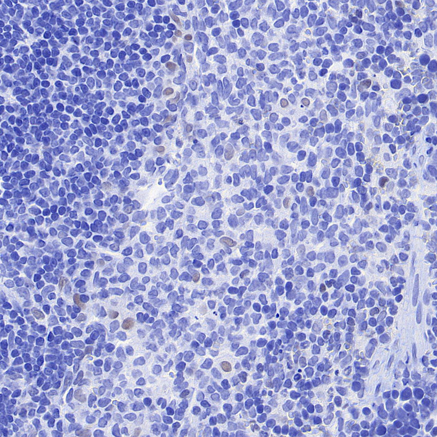 CEBPA Recombinant Rabbit mAb (S-3629-33)