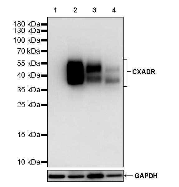 CXADR Recombinant Rabbit mAb (S-4349-1)