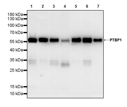 PTBP1 Rabbit Polyclonal Antibody