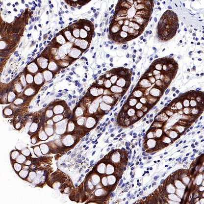 p90RSK Rabbit polyclonal antibody