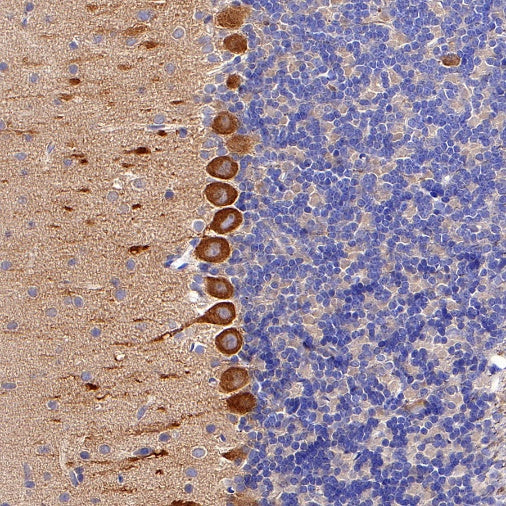 KIF3A Recombinant Rabbit mAb (S-1083-9)