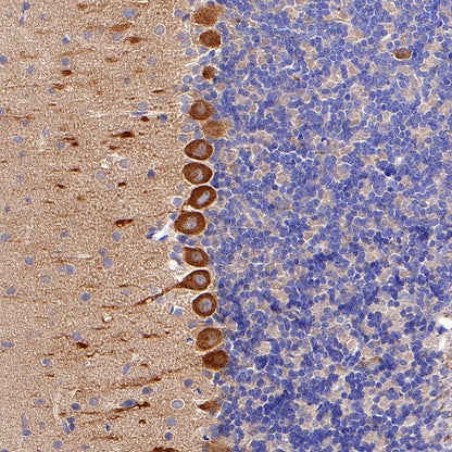 KIF3A Recombinant Rabbit mAb (S-1083-9)