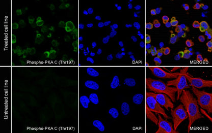 Phospho-PKA C (Thr197) Recombinant Rabbit mAb (S-1137-310)