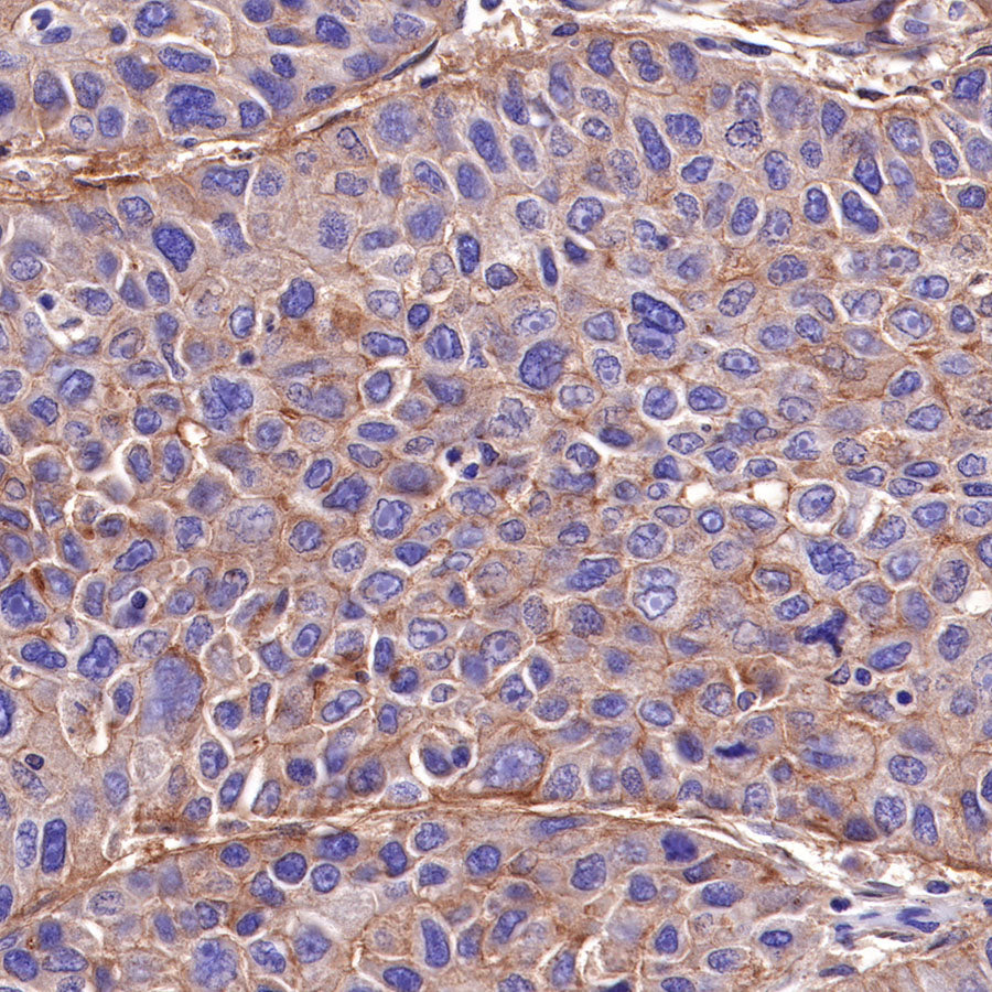 CD155/PVR Recombinant Rabbit mAb (SDT-289-68)