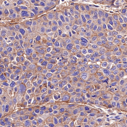 CD155/PVR Recombinant Rabbit mAb (SDT-289-68)