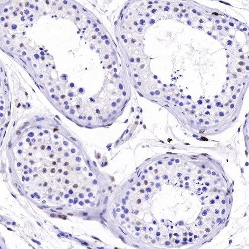 S-RMab® ATRX Recombinant Rabbit mAb (SDT-458-37)