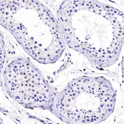 S-RMab® ATRX Recombinant Rabbit mAb (SDT-458-37)
