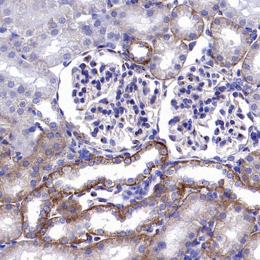 ATP7A Recombinant Rabbit mAb (S-2289-106)