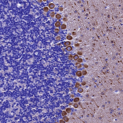 PSD-95 Recombinant Rabbit mAb (S-1518-4)