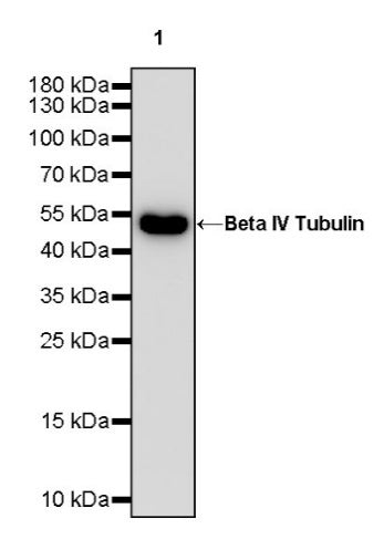 Beta IV Tubulin Recombinant Rabbit mAb (S-1572-30)