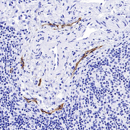 Podoplanin (D2-40) Recombinant Rabbit mAb (SDT-1178-8)