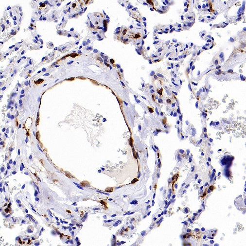 COX1/Cyclooxygenase 1 Recombinant Rabbit mAb (S-1478-48)