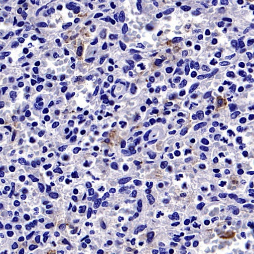 VSIG4 Recombinant Rabbit mAb (SDT-2737-61)