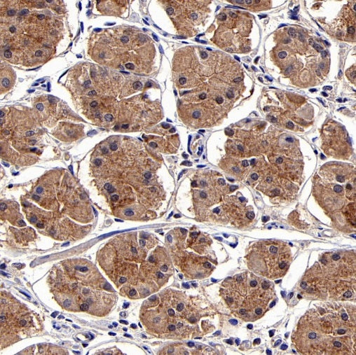 TBK1/NAK Recombinant Rabbit mAb (S-658-50)