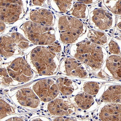 TBK1/NAK Recombinant Rabbit mAb (S-658-50)