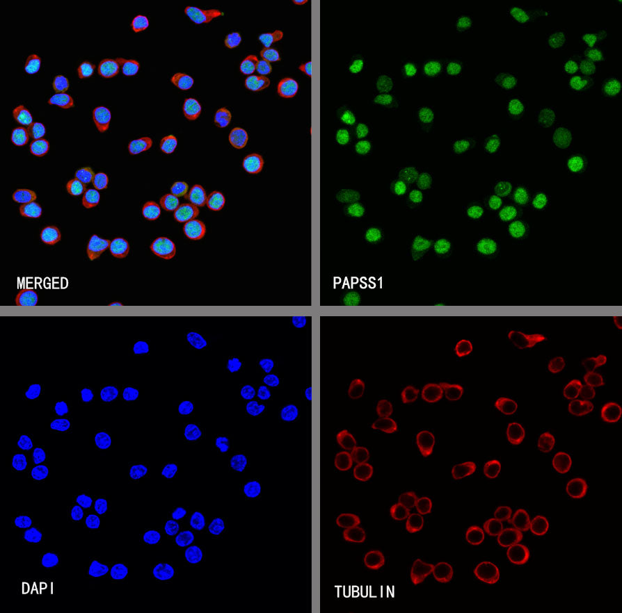 PAPSS1 Recombinant Rabbit mAb (S-3516-9)