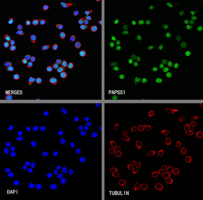 PAPSS1 Recombinant Rabbit mAb (S-3516-9)