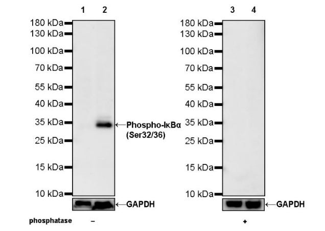 Phospho-IκBα (Ser32/36) Recombinant Rabbit mAb (S-R362)
