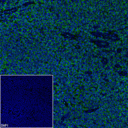 CD45 Recombinant Mouse mAb (S-429-1)