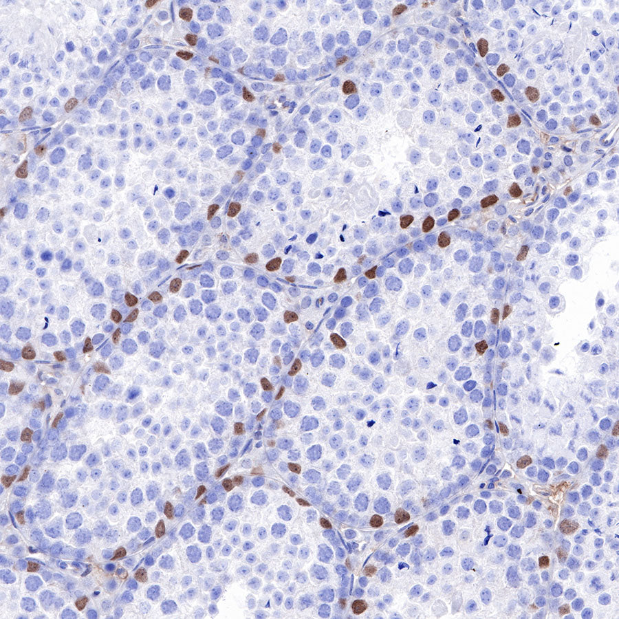 SOX9 Recombinant Rabbit mAb (SDT-019-29)
