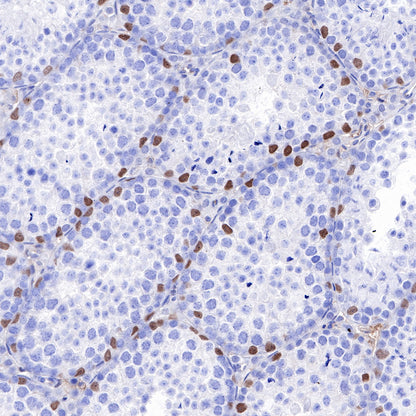 SOX9 Recombinant Rabbit mAb (SDT-019-29)