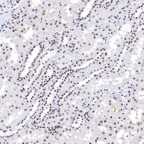 Histone H3 (di methyl K14) Recombinant Rabbit mAb (S-R414)