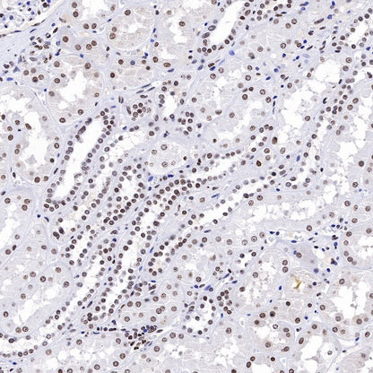 Histone H3 (di methyl K14) Recombinant Rabbit mAb (S-R414)