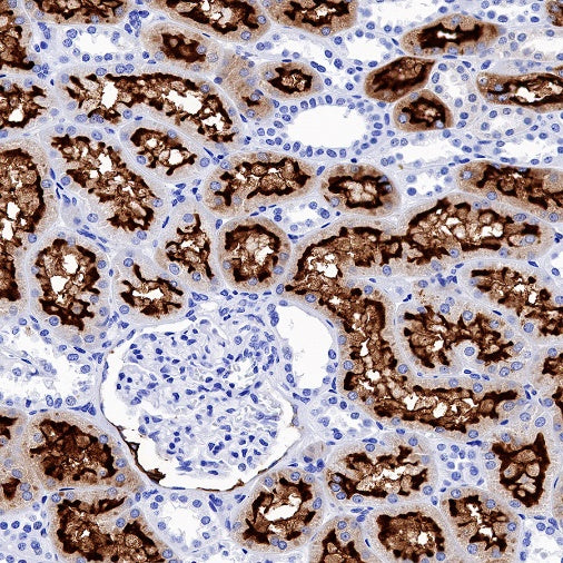 ACE2 Recombinant Rabbit mAb (S-1348-7)