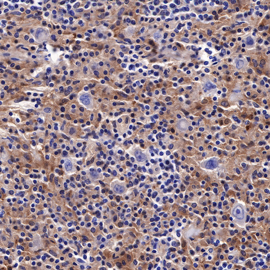 Galectin-3 Recombinant Rabbit mAb (SDT-370-111)