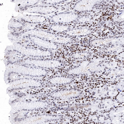 Histone H3 (di methyl K14) Recombinant Rabbit mAb (S-R414)