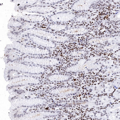 Histone H3 (di methyl K14) Recombinant Rabbit mAb (S-R414)