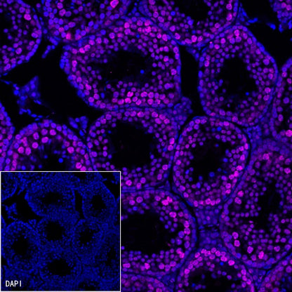 RNA polymerase II CTD repeat YSPTSPS (phosphor S2) Recombinant Rat mAb (S-R199)