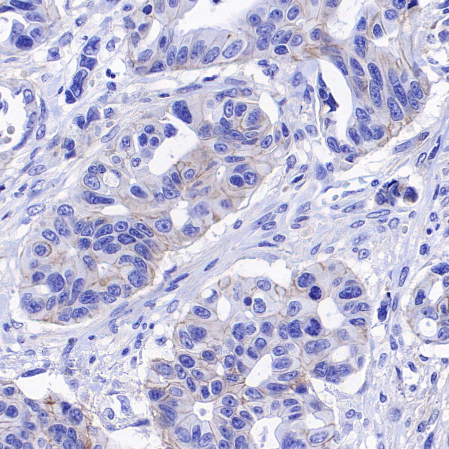 ABCC1/MRP1 Recombinant Rabbit mAb (SDT-4056-11)