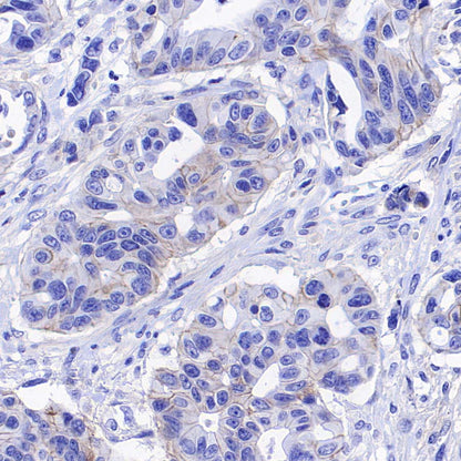 ABCC1/MRP1 Recombinant Rabbit mAb (SDT-4056-11)