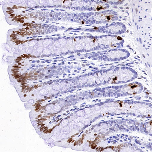 Phospho-Histone H3 (Ser28) Recombinant Rabbit mAb (S-1025-45)