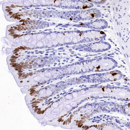 Phospho-Histone H3 (Ser28) Recombinant Rabbit mAb (S-1025-45)