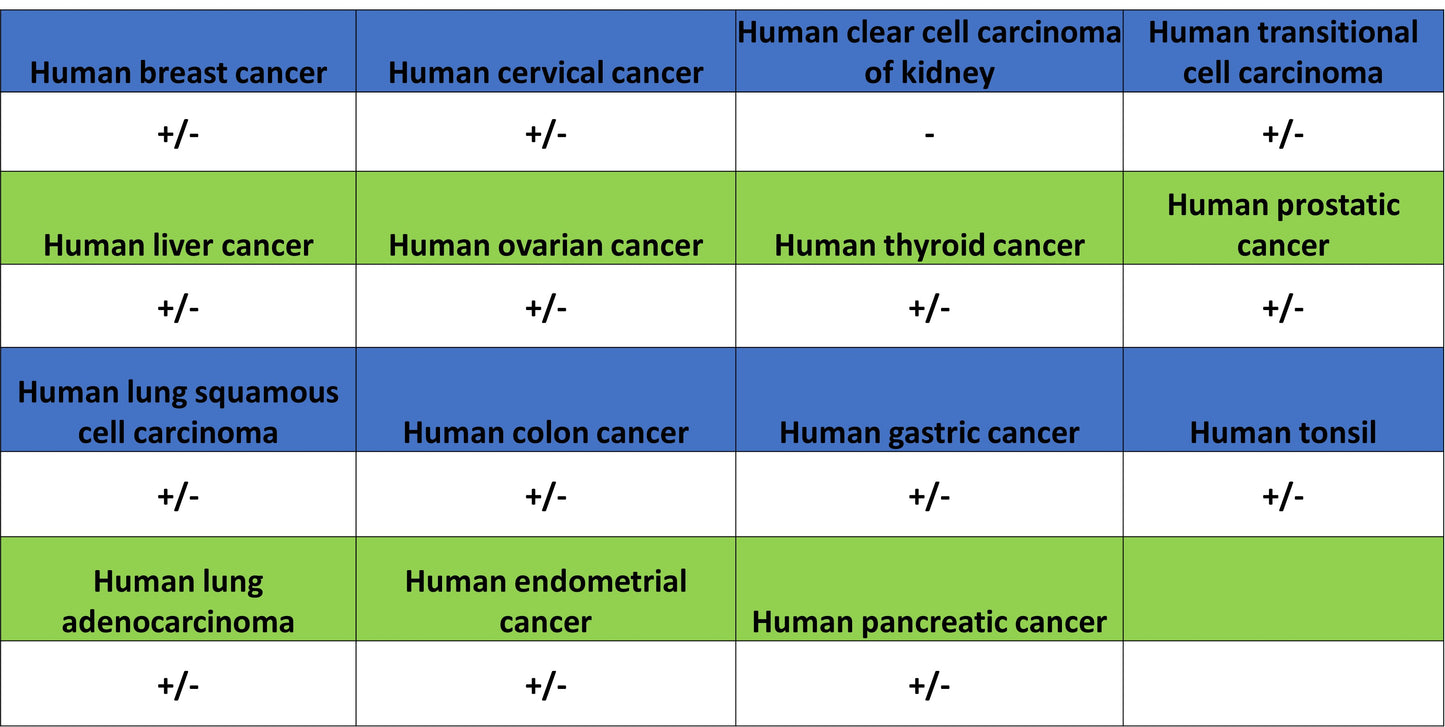 NDUFB8 Recombinant Mouse mAb (S-M0007)