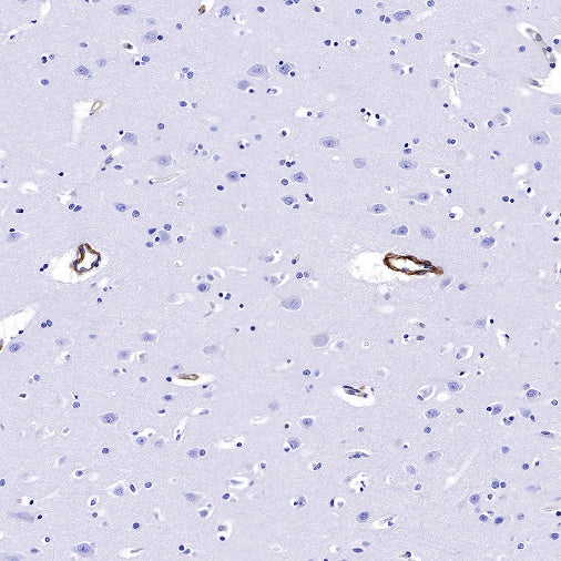 CD239 Recombinant Rabbit mAb (S-R284)