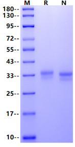 VSIG3/IGSF11 His Tag Protein, Human