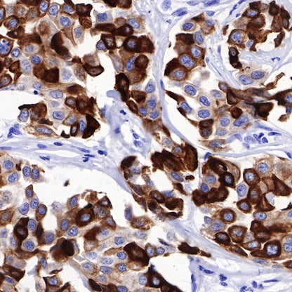 CK8/18 Recombinant Rabbit mAb (SDT-P005)