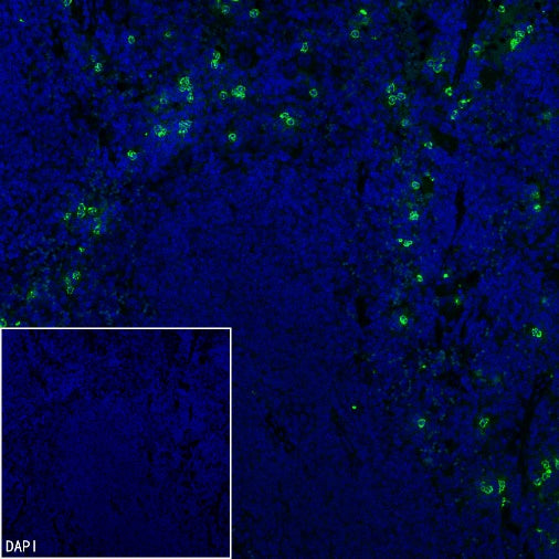 Lipocalin-2/NGAL Recombinant Rabbit mAb (S-2280-129)